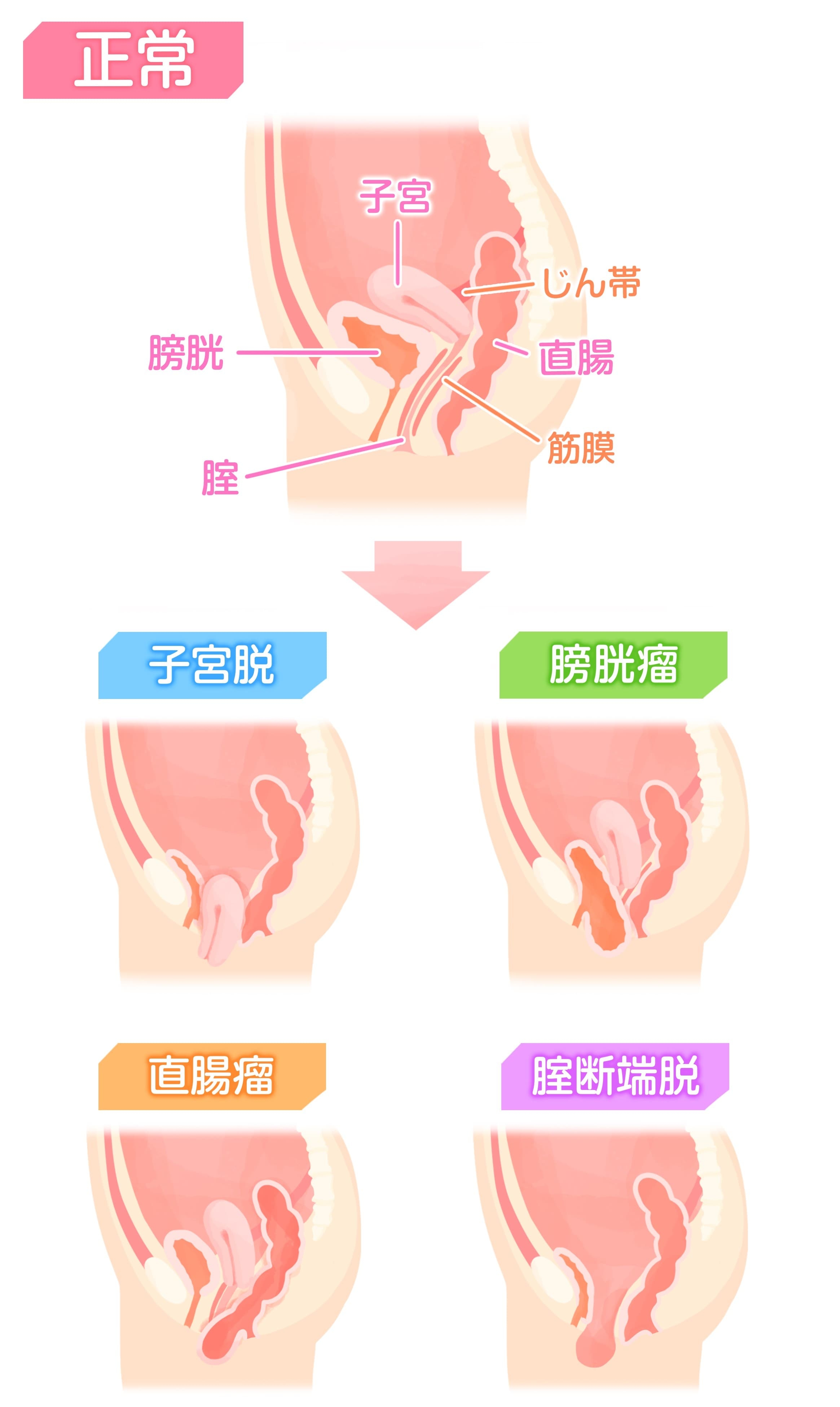 膣 の 感触